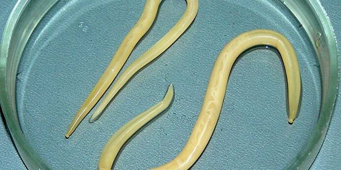 Човешки кръгли червеи в паничка на Петри - паразитират по стените на тънките черва